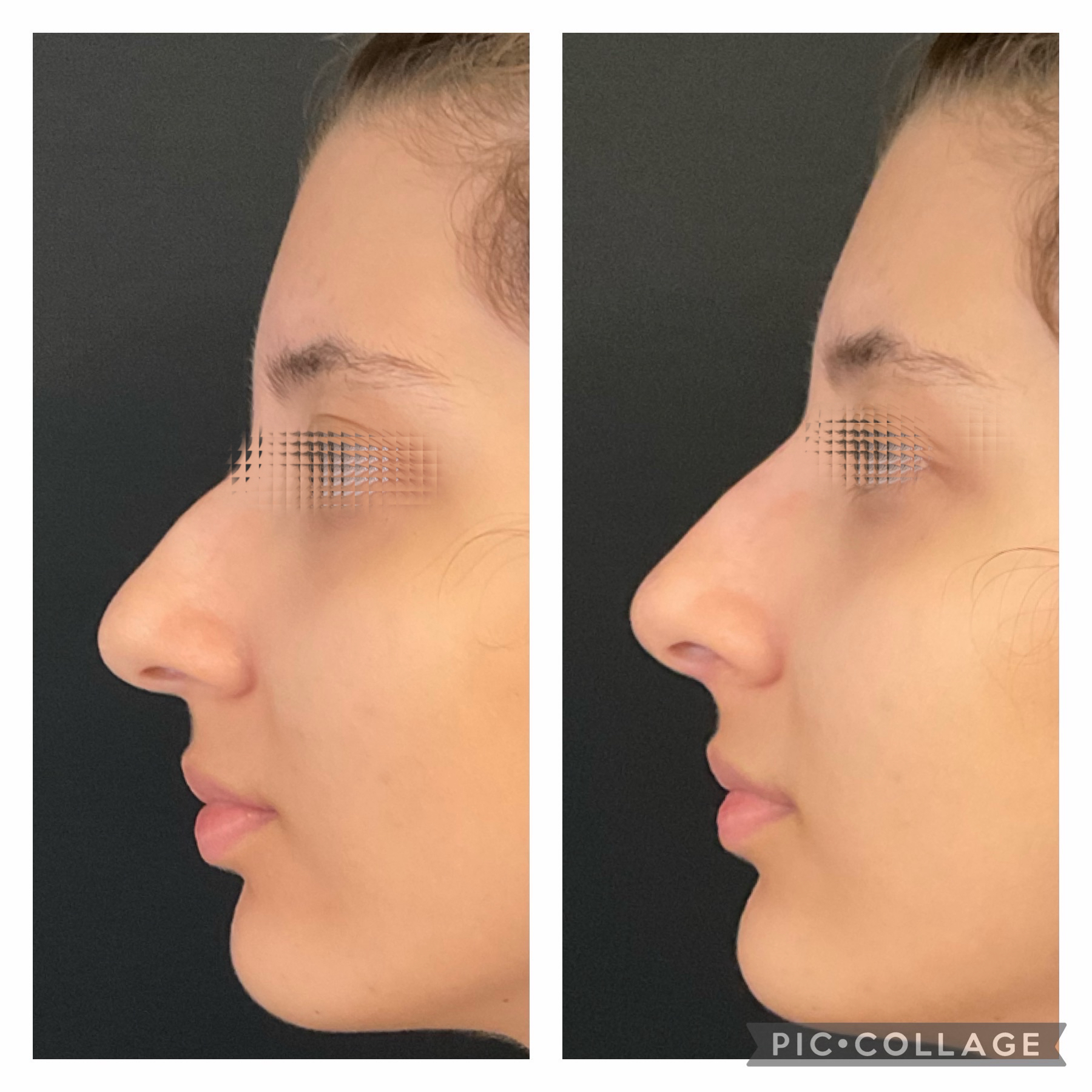 Resultados Excepcionais